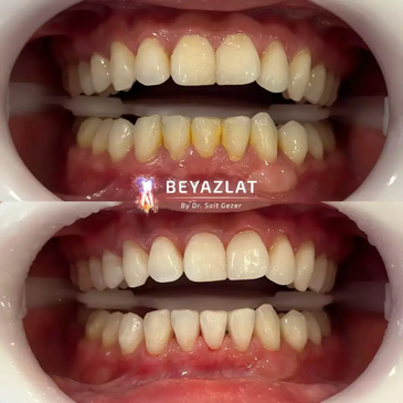 Slider image (8) Dr. Sait Gezer